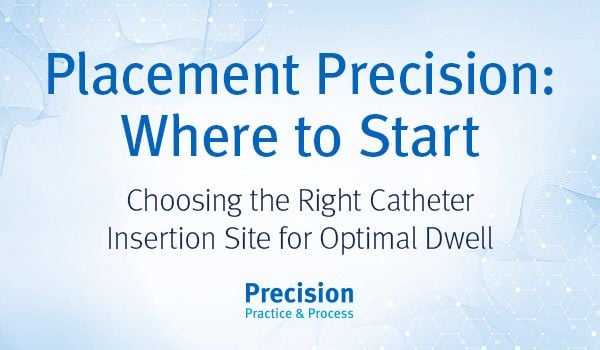 Placement Precision – Why Site Selection Matters Placement Precision – Why Site Selection Matters